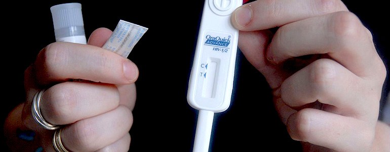 Test Hiv gratuiti agli studenti