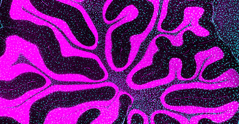 natmet_sett19_mesospim
