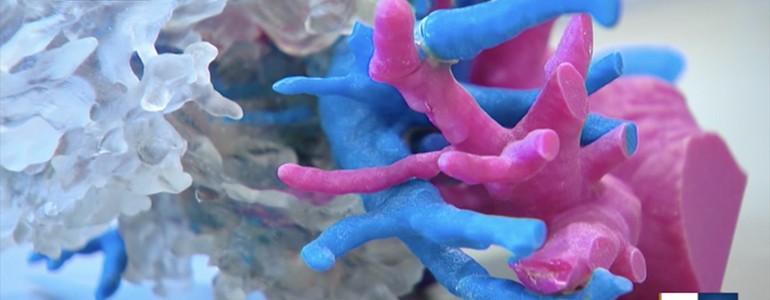 Stampa 3D, gli ingegneri dell’Università di Pavia al servizio dei chirurghi (video)